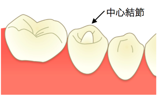 歯の真ん中から角(ツノ)のような物が生えているのですが？ | いわきり歯科 | 宮崎市吉村町の歯医者さん
